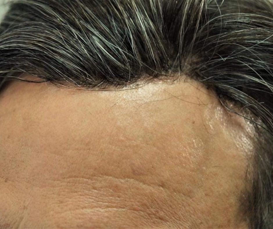 Formation, Pose et Vente Ab Extensions Laval Brossard Repentigny